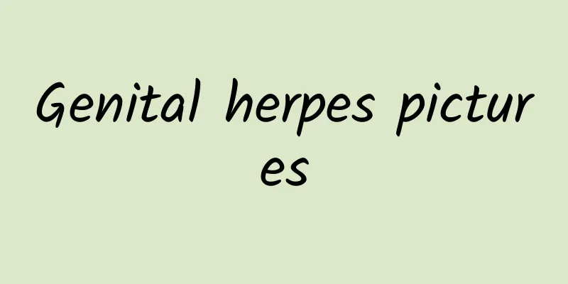 Genital herpes pictures