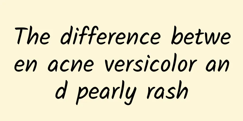 The difference between acne versicolor and pearly rash
