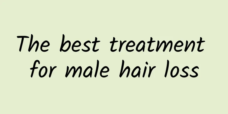 The best treatment for male hair loss