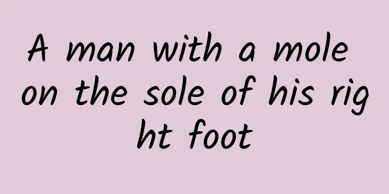 A man with a mole on the sole of his right foot
