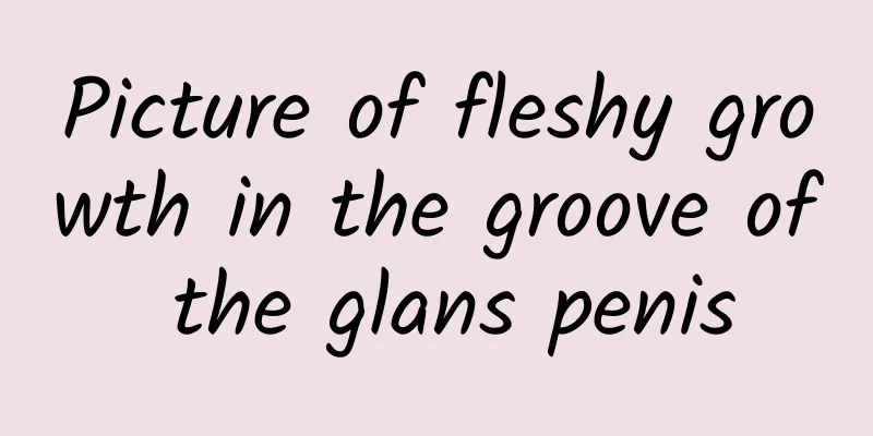 Picture of fleshy growth in the groove of the glans penis