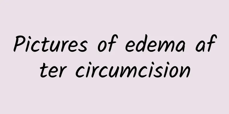 Pictures of edema after circumcision
