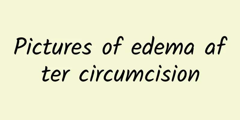 Pictures of edema after circumcision