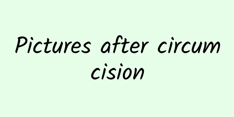 Pictures after circumcision