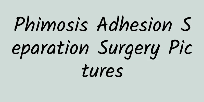 Phimosis Adhesion Separation Surgery Pictures