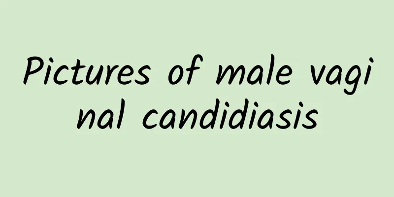 Pictures of male vaginal candidiasis