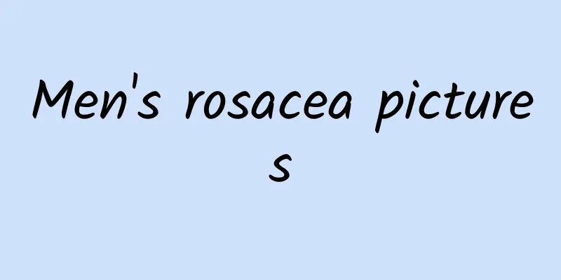Men's rosacea pictures