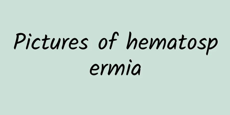 Pictures of hematospermia