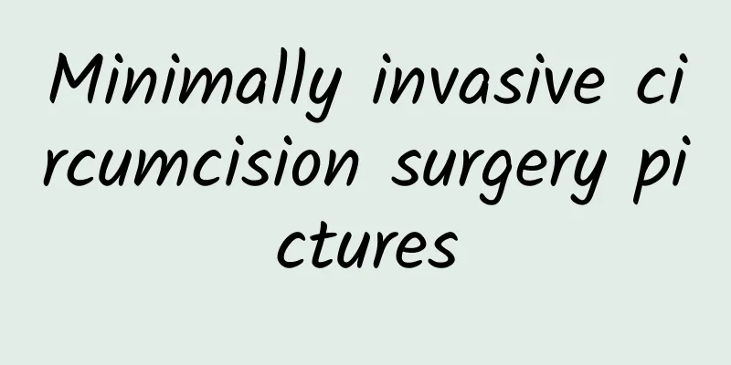 Minimally invasive circumcision surgery pictures