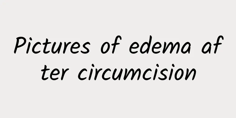 Pictures of edema after circumcision
