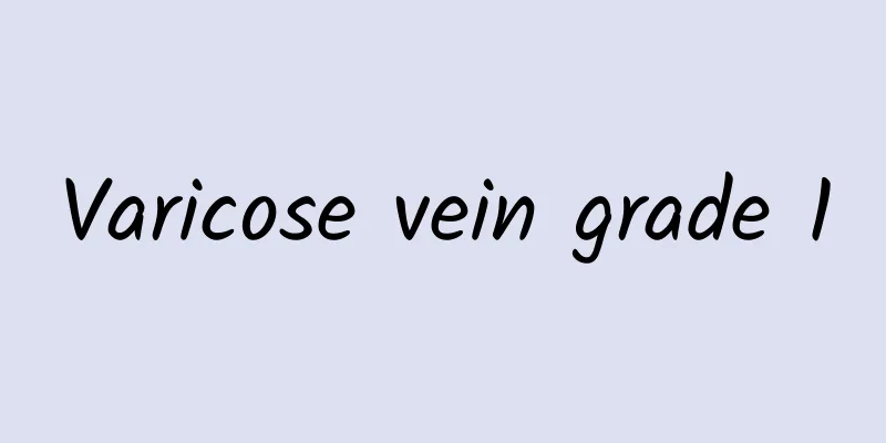 Varicose vein grade 1