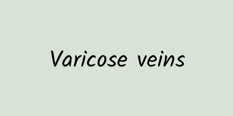 Varicose veins