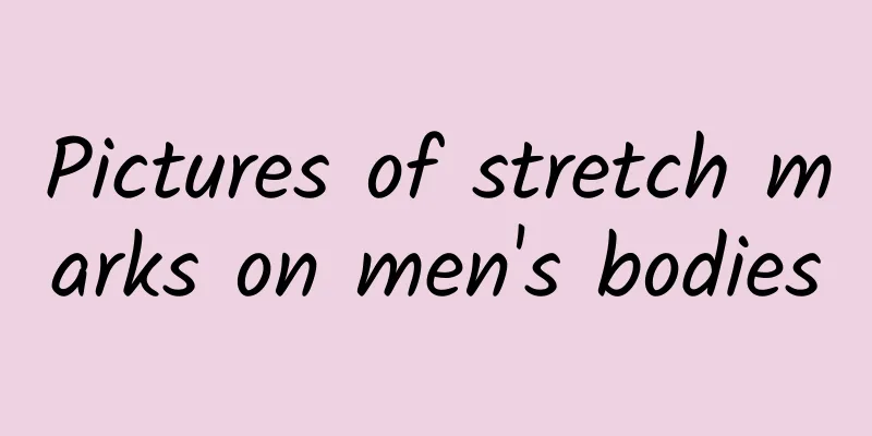 Pictures of stretch marks on men's bodies