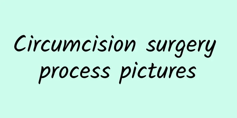 Circumcision surgery process pictures