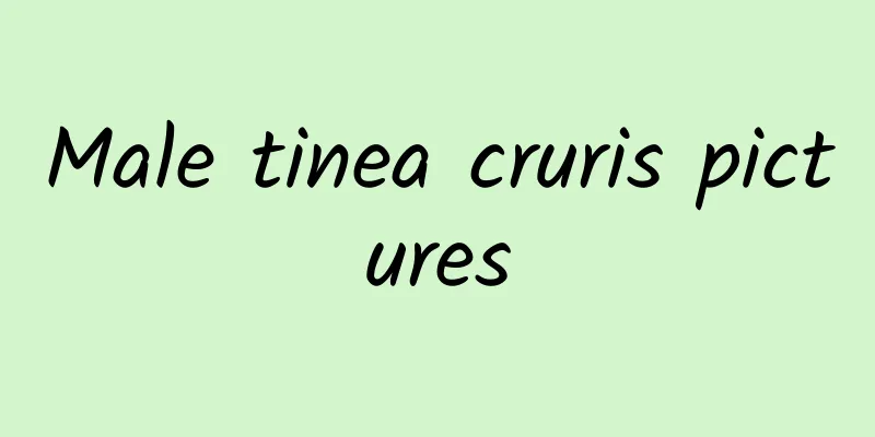 Male tinea cruris pictures