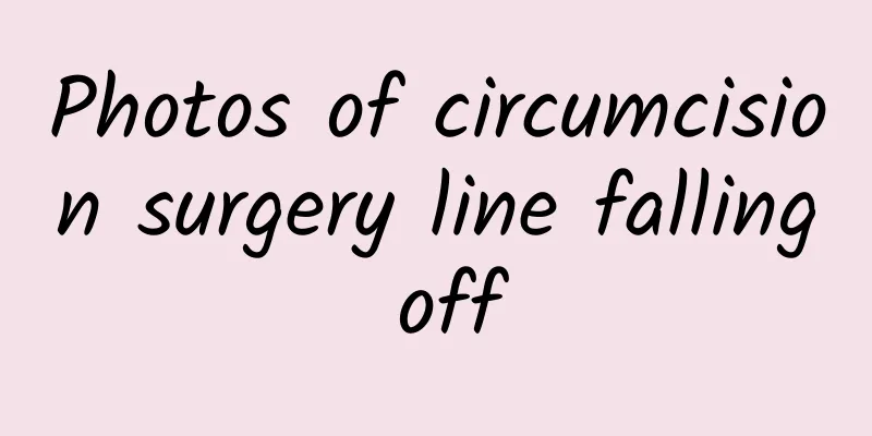 Photos of circumcision surgery line falling off