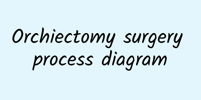 Orchiectomy surgery process diagram