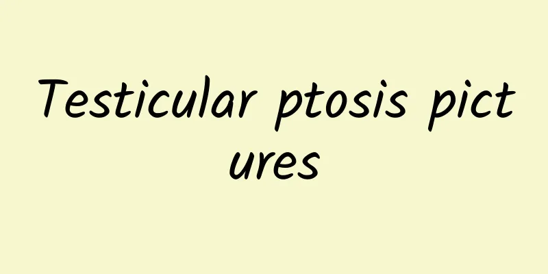 Testicular ptosis pictures