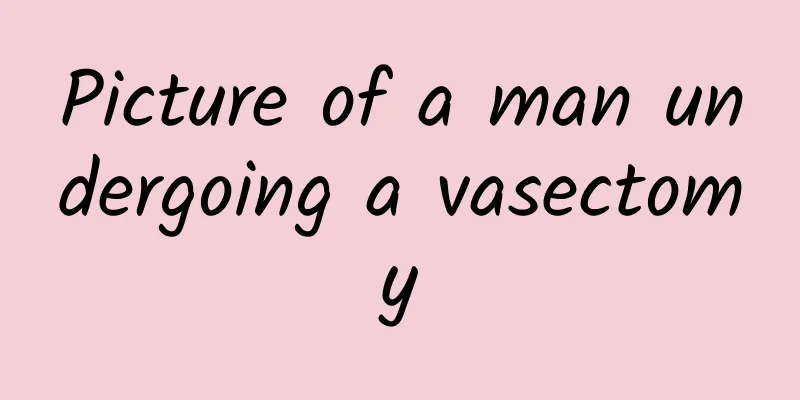 Picture of a man undergoing a vasectomy