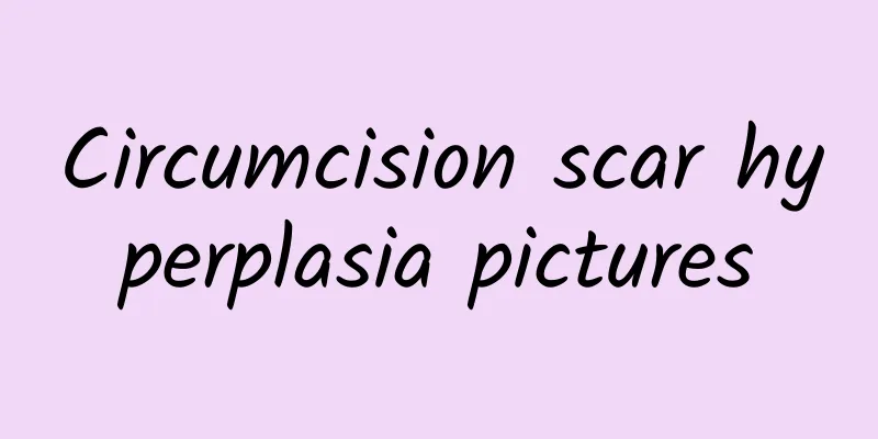Circumcision scar hyperplasia pictures
