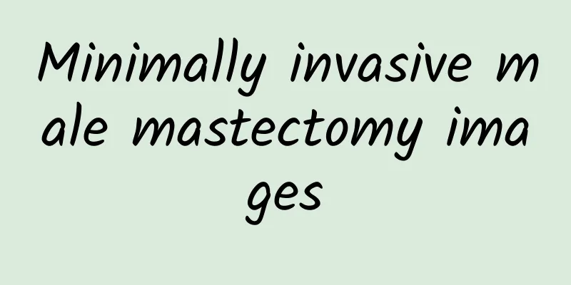 Minimally invasive male mastectomy images