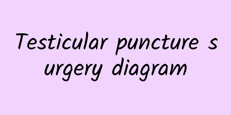 Testicular puncture surgery diagram