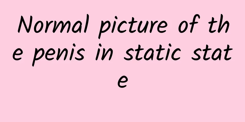 Normal picture of the penis in static state