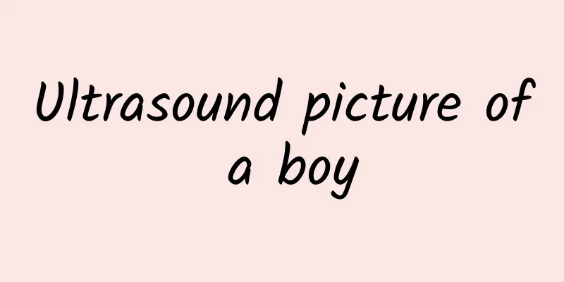 Ultrasound picture of a boy