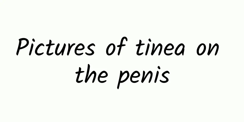 Pictures of tinea on the penis