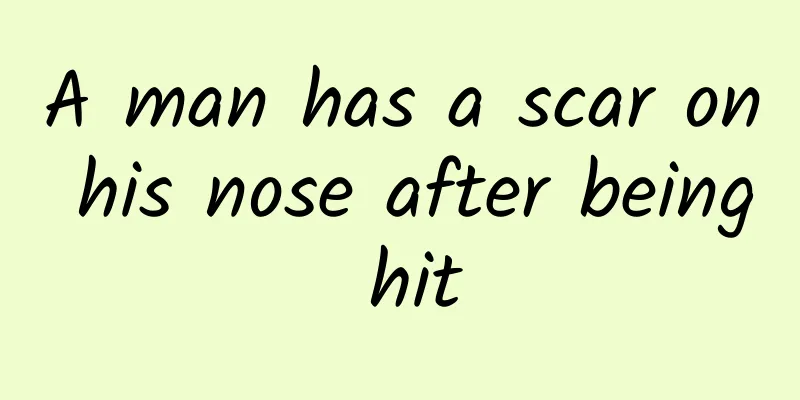 A man has a scar on his nose after being hit