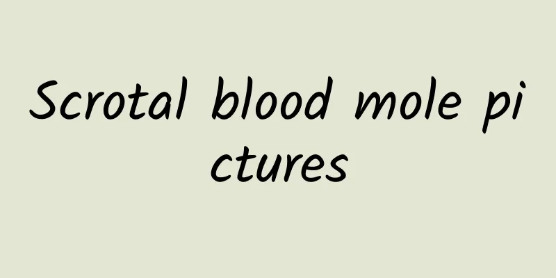 Scrotal blood mole pictures
