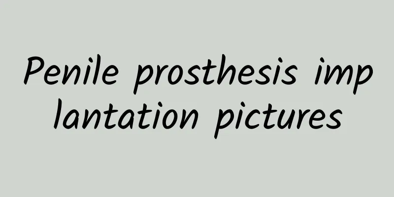 Penile prosthesis implantation pictures