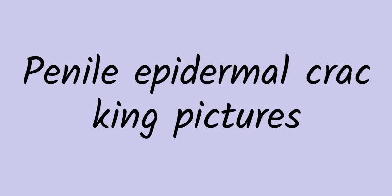 Penile epidermal cracking pictures