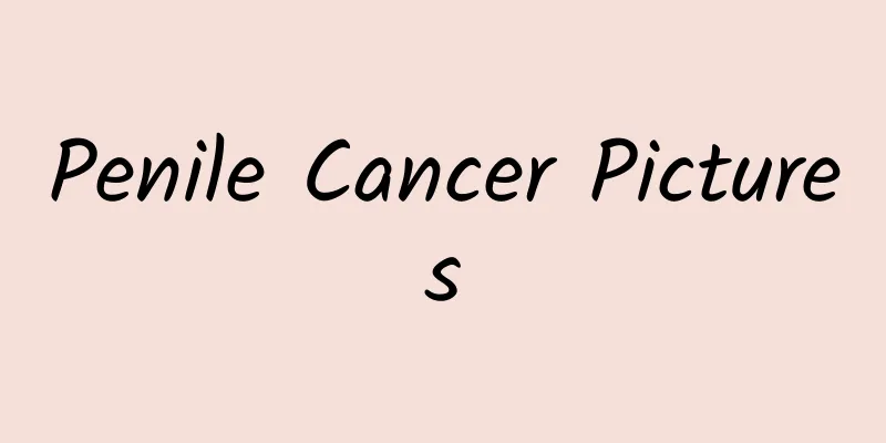 Penile Cancer Pictures