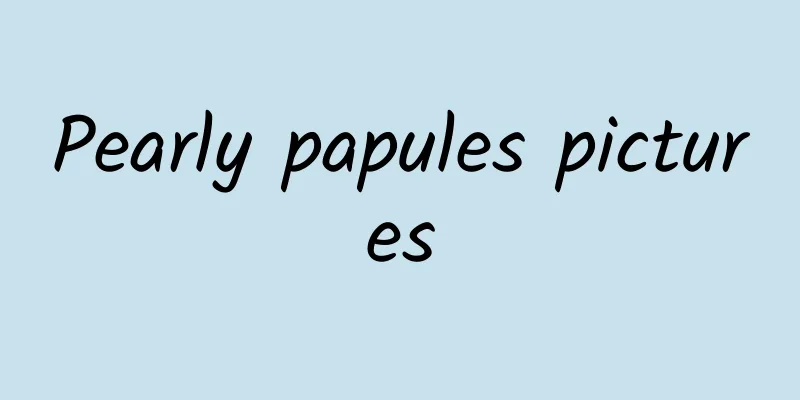 Pearly papules pictures
