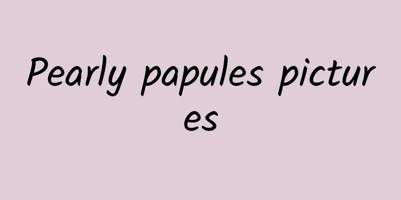 Pearly papules pictures