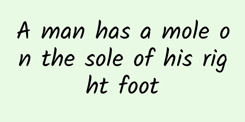 A man has a mole on the sole of his right foot