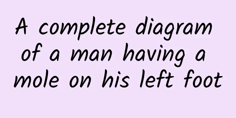 A complete diagram of a man having a mole on his left foot