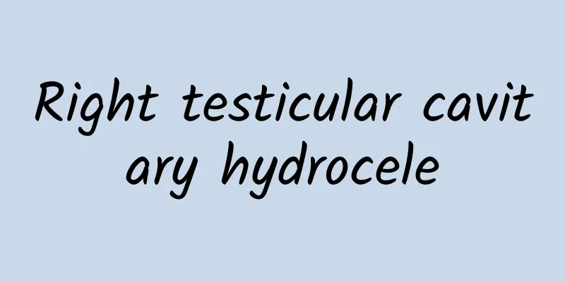 Right testicular cavitary hydrocele