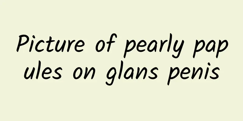 Picture of pearly papules on glans penis
