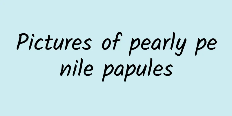 Pictures of pearly penile papules