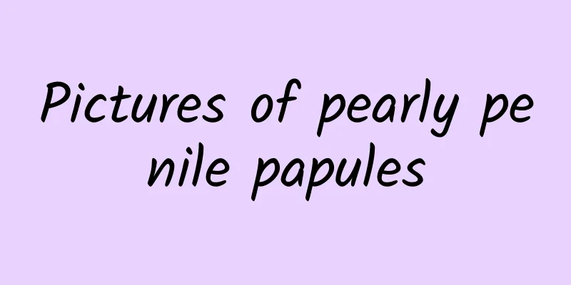 Pictures of pearly penile papules
