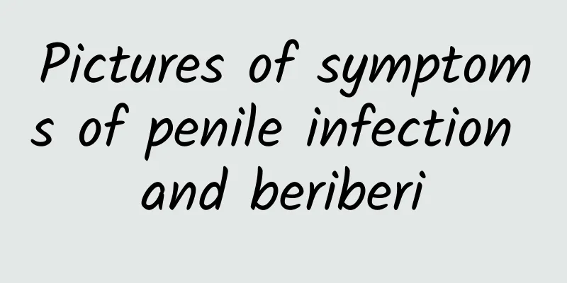 Pictures of symptoms of penile infection and beriberi