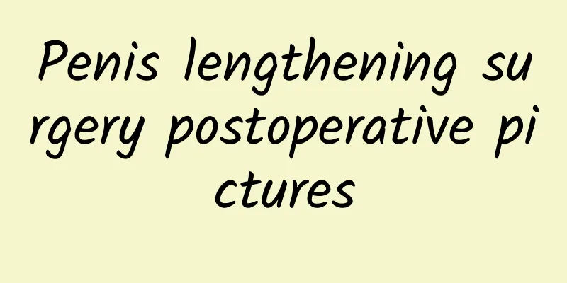 Penis lengthening surgery postoperative pictures