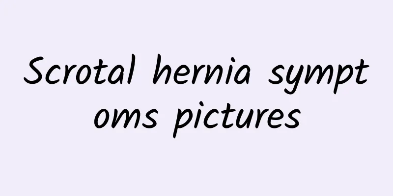 Scrotal hernia symptoms pictures