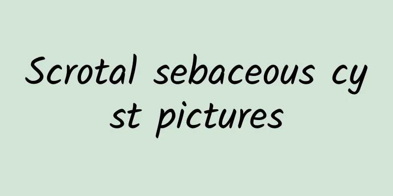 Scrotal sebaceous cyst pictures