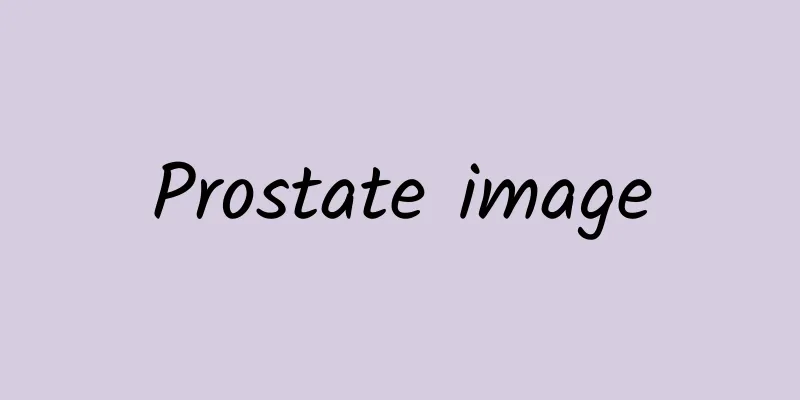Prostate image