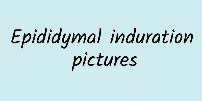 Epididymal induration pictures