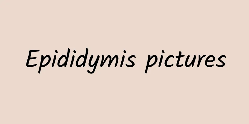 Epididymis pictures