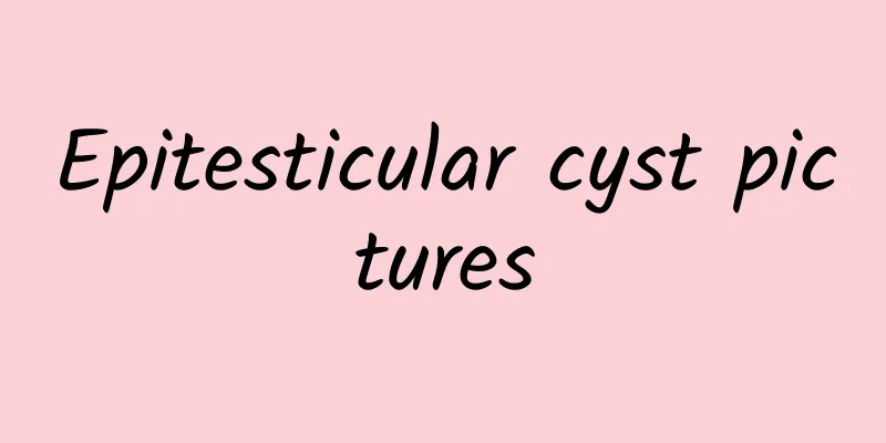 Epitesticular cyst pictures